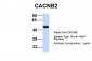 CACNB4 antibody - middle region